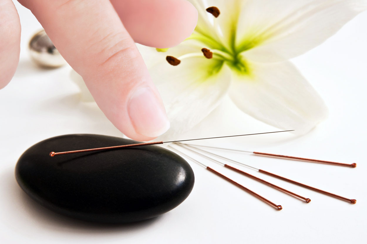 Acupuncture-with-black-stone-and-needles